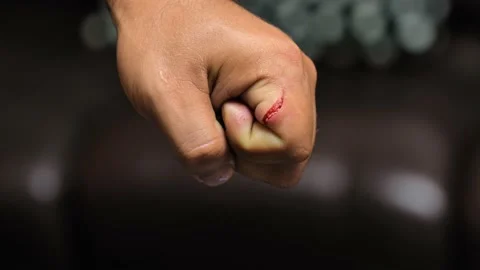 Deep scratches, cut on man hand skin. Stock Footage 232121053