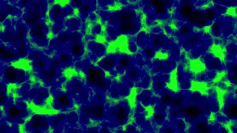Deep tissue in the human body or living creatures that looks very complicated Stock Footage 300188506