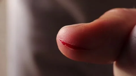 Deep wound on thumb from a knife cut, a human household injury. Stock Footage 292245804