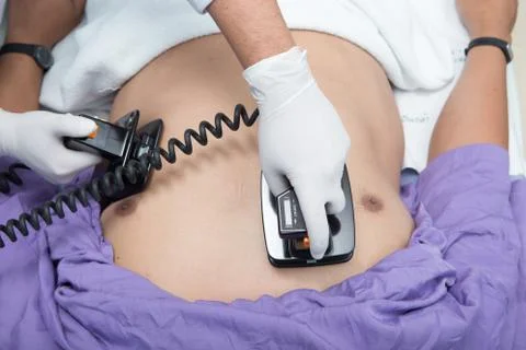 Defibrillator practice on a CPR Foto stock