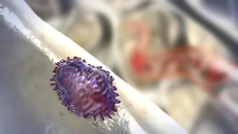 Deficiency of calcium and bone resorption Stock Illustration