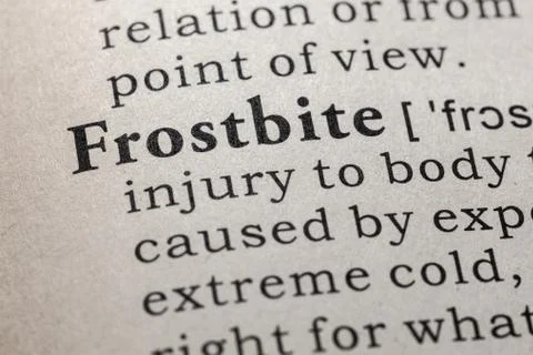 Definition of frostbite Foto stock