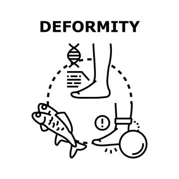 Deformity causing suffering and genetic medical problems Stock Illustration