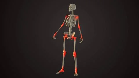 Degenerative Arthritis Affecting Inner Joints Stock Illustration
