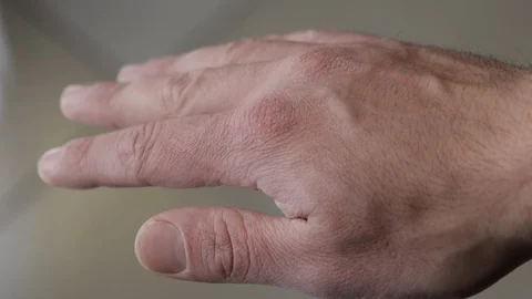 Dehydrated isolated athlete hand. Close up of caucasian hand with dry skin Stock Footage 126542397