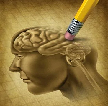 Dementia disease Stock Illustration