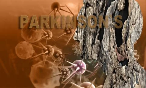 Dementia Stock Illustration