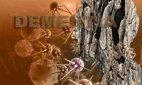 Dementia Stock Illustration