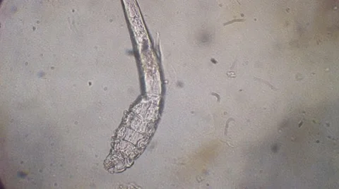 Demodectic Mange Video stock 64219261