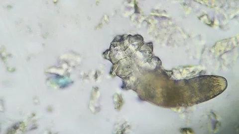 Demodex Face Mite Under the Microscope Stock Footage 285787273