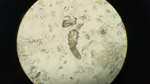 Demodex Face Mite Under the Microscope Stock Footage 285787305