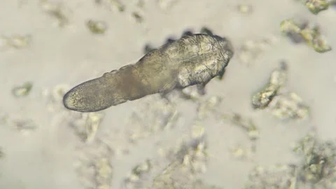 Demodex Face Mite Under the Microscope Stock Footage 285787815