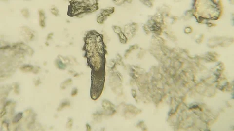 Demodex Face Mite Under the Microscope Stock Footage 285787823