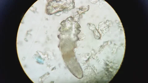 Demodex Face Mite Under the Microscope Stock Footage 285788186