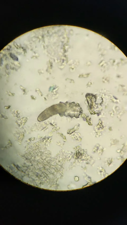 Demodex Face Mite Under the Microscope Stock Footage 285788394