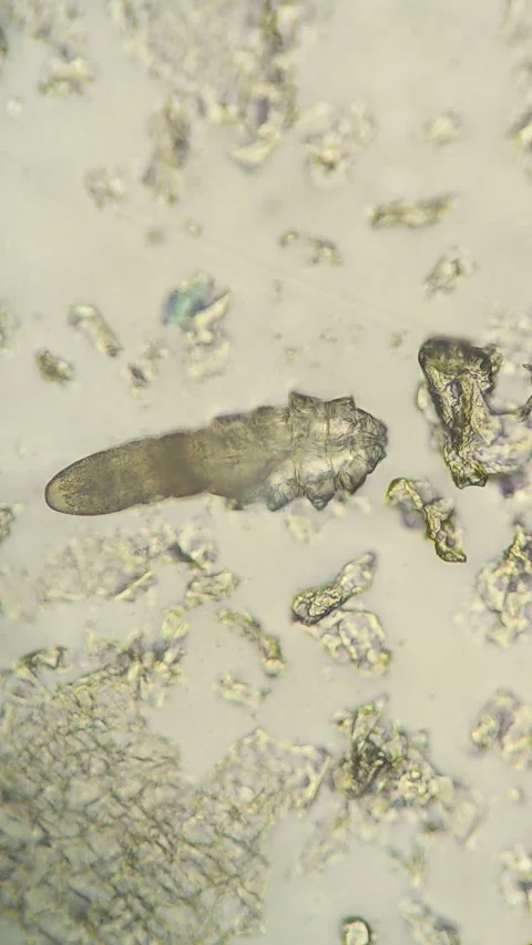 Demodex Face Mite Under the Microscope Stock Footage 285788449
