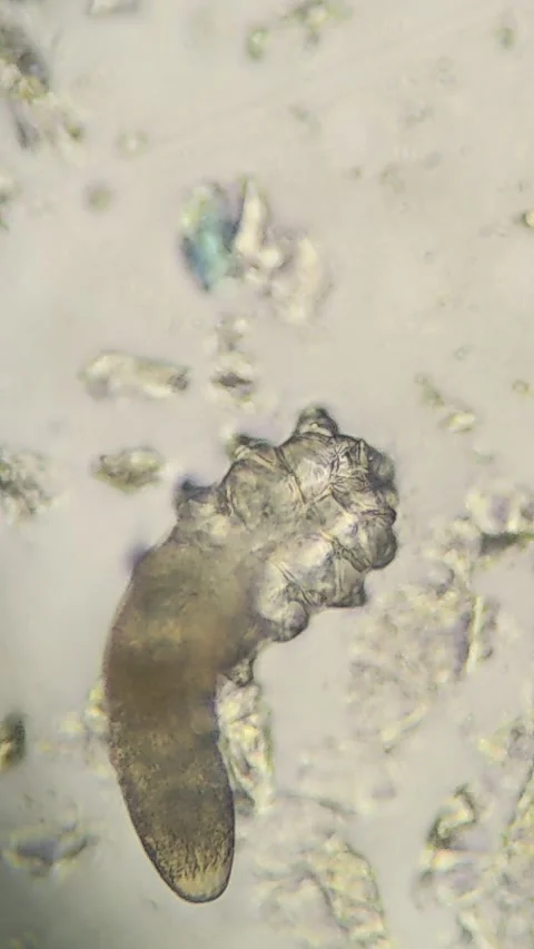 Demodex Face Mite Under the Microscope Stock Footage 285788662