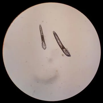 Demodex folliculorum - parasitic mite on the eyelashes of a human eye Stock Photos