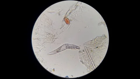 Demodex under microscope Stock Footage 120870420