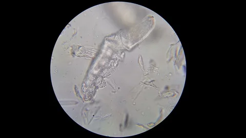 Demodex under microscopoe Stock Footage 120870731