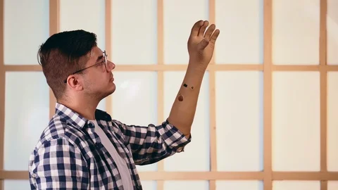 Demonstrate prosthetic hand. Show prosthesis arm. Invalid motion limb amputee. 스톡 동영상 114774501