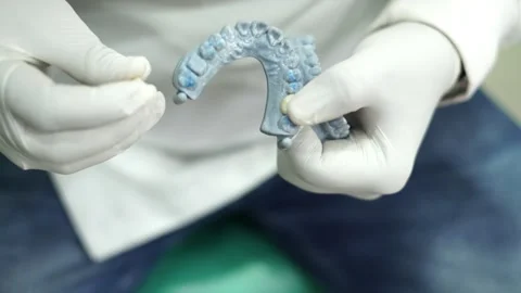 Impression Dental Stock Videos – Royalty-Free HD & 4K Videos