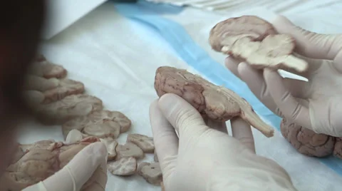 Demonstration with miniature brain Stock Footage 39375058