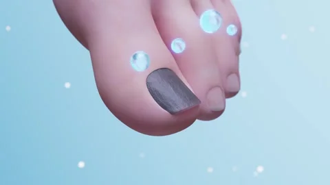 Demonstration of the treatment process for onychomycosis 库存影片 313970053