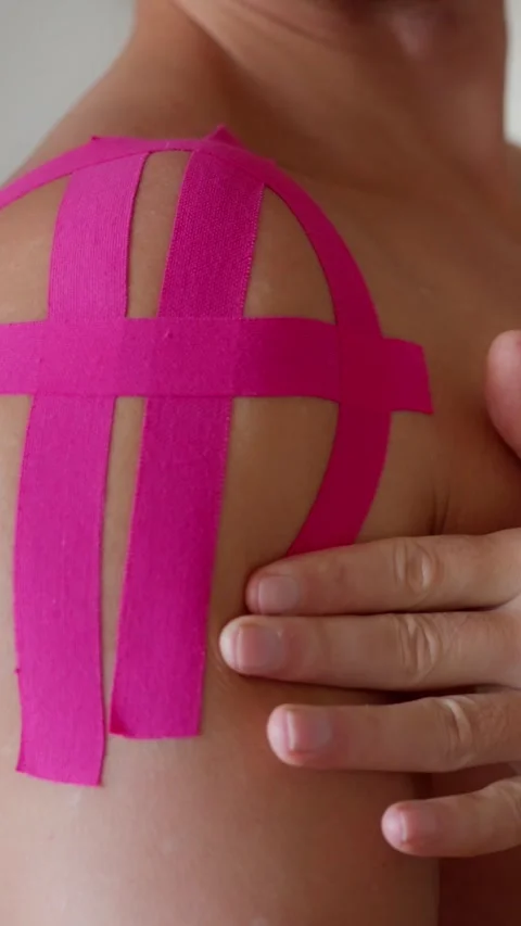 This demonstration will show you how to properly apply pink kinesiology tape on Stock Footage 308864201