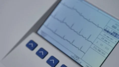 Demonstration of working cardiograph screen. Out of focus and then in focus. Stock Footage 120464197