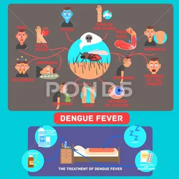 Dengue Fever Infographics. Vector Illustration Illustration #58936220