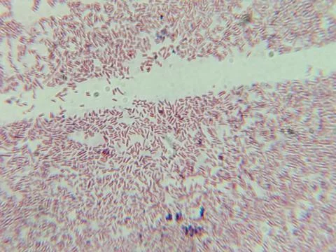 Dense Clumps of Rod-Shaped Bacteria (Bacilli) Under a Microscop 写真素材
