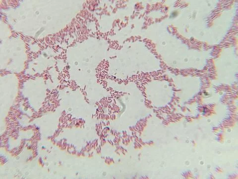 Dense Clumps of Rod-Shaped Bacteria (Bacilli) Under a Microscop Stock Photos