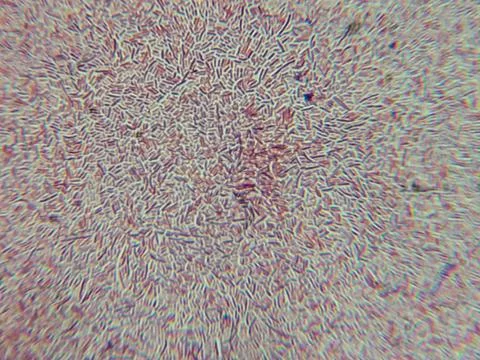 Dense Clumps of Rod-Shaped Bacteria (Bacilli) Under a Microscop Stock Photos