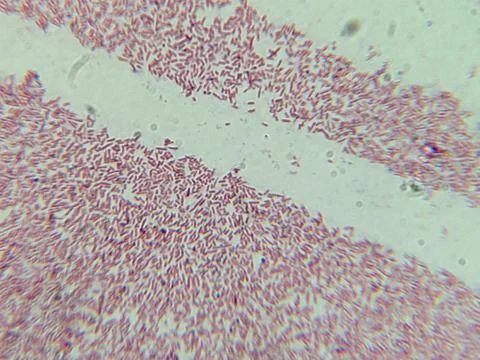 Dense Clumps of Rod-Shaped Bacteria (Bacilli) Under a Microscop Stock Photos