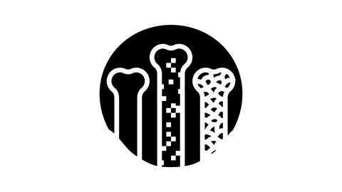 Density bone osteoporosis glyph icon animation Stock Footage 326150962
