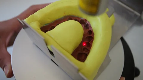 Dent 12.mp4 Stock Footage 33834795