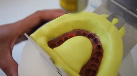 Dent 13.mp4 Stock Footage 33834842