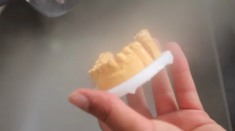 Dent 21.mp4 Stock Footage 33836478