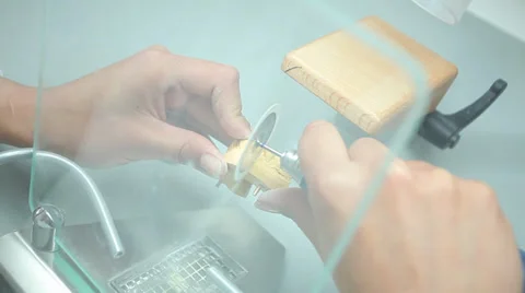 Dent 24.mp4 Stock Footage 33837023