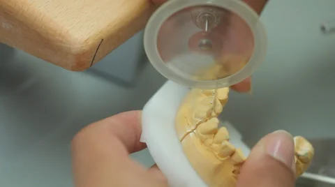 Dent 26.mp4 Stock Footage 33837938