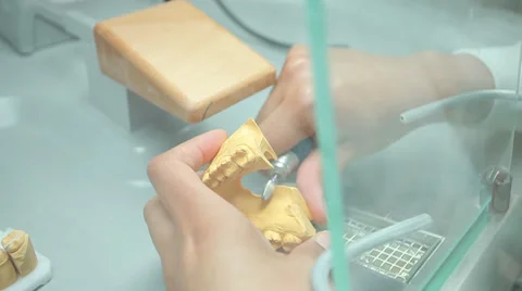 Dent 30.mp4 Stock Footage 33839979