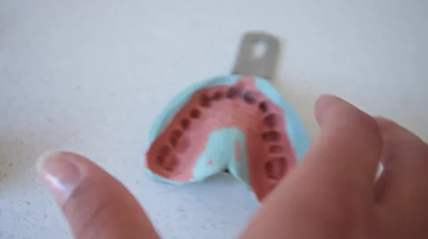 Dent 3.mp4 Stock Footage 33831016