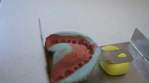 Dent 4.mp4 Stock Footage 33831094