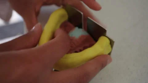 Dent 6.mp4 Stock Footage 33831322