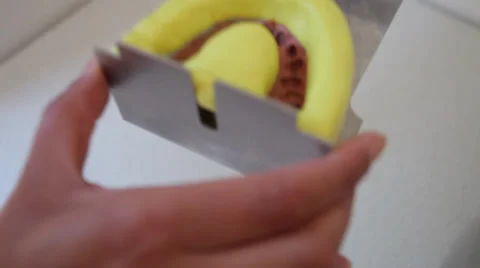 Dent 8.mp4 Stock Footage 33831440