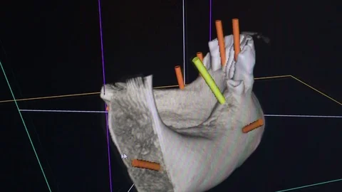 Dental 3d radiographs Stock Footage 128453333