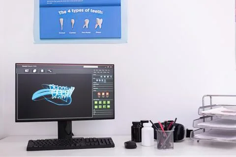 Dental 3d scan on computer screen Stock Photos