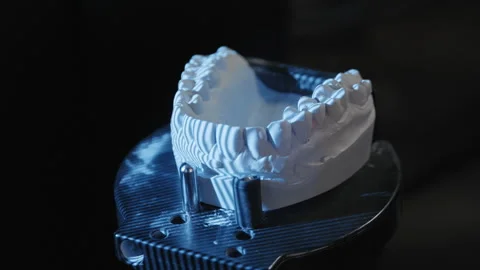 Dental 3D scanner creating digital model of jaw Stock Footage 336626832