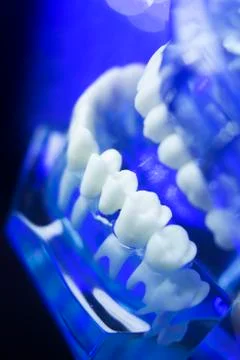 Dental alignment teeth model Stock-Fotos